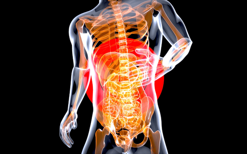 Cause 12: Malabsorption Disorders